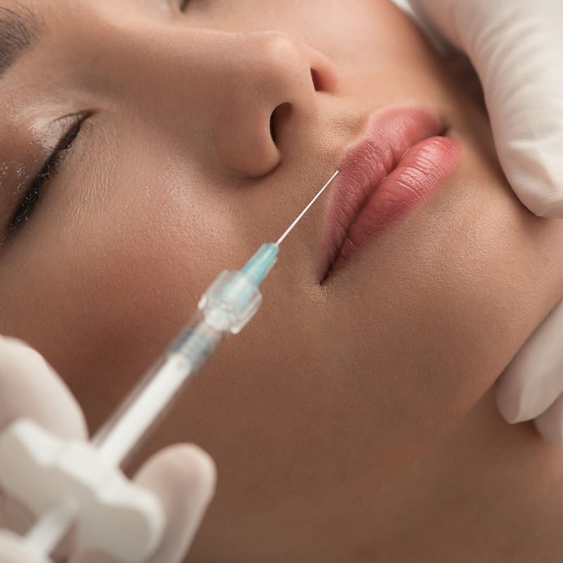 Dermal Fillers applied via injection at MGMD Aesthetics